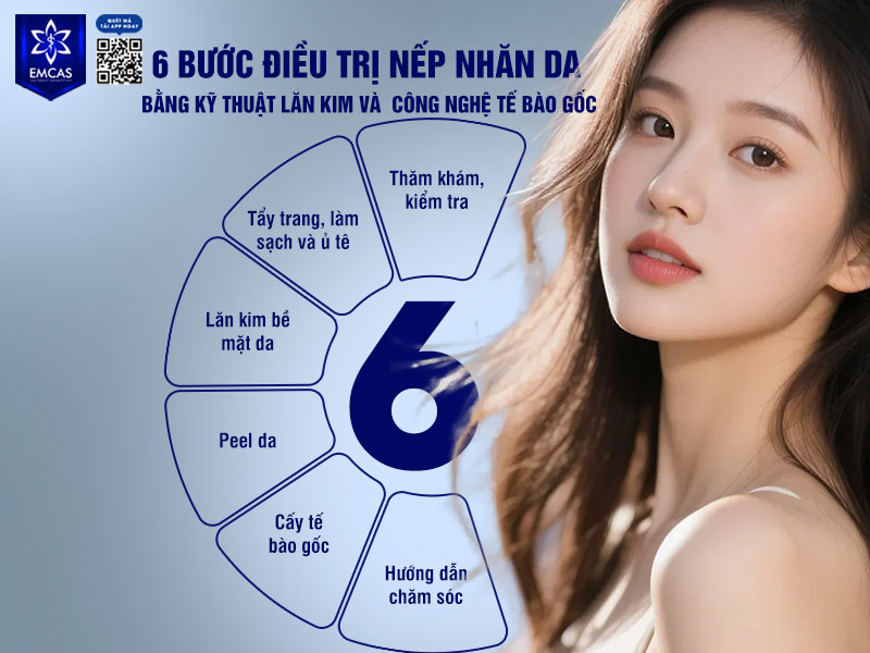 Điều trị nếp nhăn da bằng kỹ thuật lăn kim và công nghệ tế bào gốc thường được thực hiện theo quy trình chuẩn y khoa nhằm hỗ trợ tối ưu hiệu quả phục hồi và tái tạo làn da.
