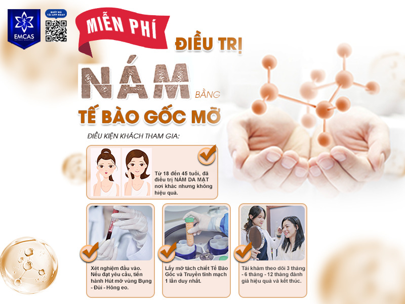 Tháng 07/2022, Bệnh Viện Thẩm Mỹ EMCAS được Bộ Y tế cấp phép nghiên cứu thử nghiệm điều trị rám má bằng tế bào gốc trung mô từ mô mỡ đã qua nuôi cấy kết hợp nội tiết tố và sử dụng Laser bề mặt.