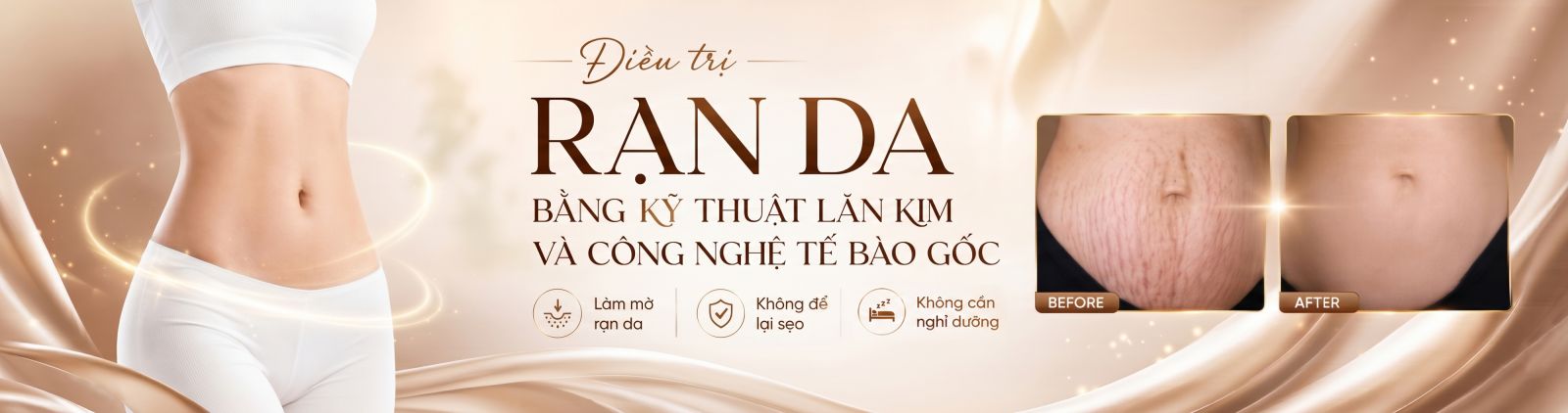 Banner Service Detail
