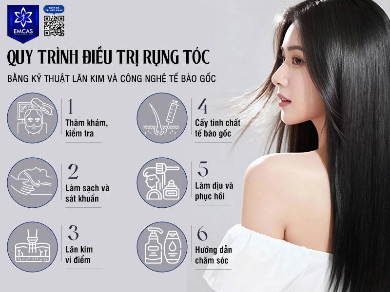 Quy trình điều trị rụng tóc được thực hiện theo từng bước khoa học, đảm bảo an toàn và hiệu quả, từ khâu thăm khám ban đầu cho đến lăn kim, cấy tế bào gốc và chăm sóc sau điều trị nhằm tối ưu khả năng phục hồi nang tóc.