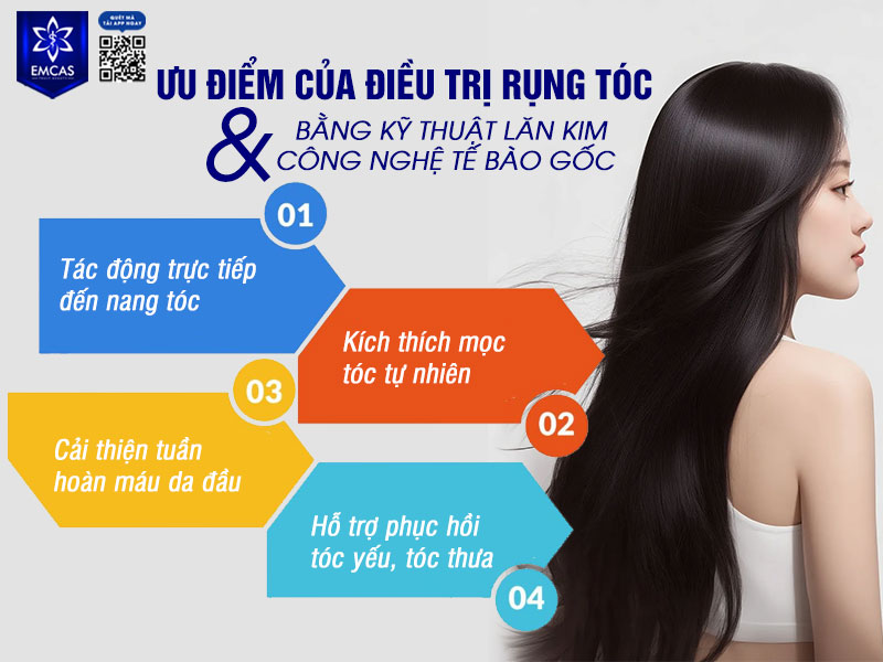 Điều trị rụng tóc bằng kỹ thuật lăn kim kết hợp công nghệ tế bào gốc mang lại nhiều ưu điểm nổi bật nhờ cơ chế tác động sâu vào nang tóc, giúp cải thiện tình trạng tóc yếu và rụng kéo dài.
