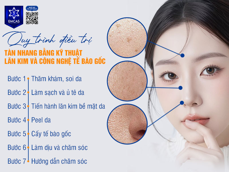 Quy trình điều trị tàn nhang bằng lăn kim kết hợp công nghệ tế bào gốc thường được thực hiện theo các bước cơ bản dưới đây nhằm đảm bảo an toàn và hỗ trợ tối ưu hiệu quả cải thiện da.