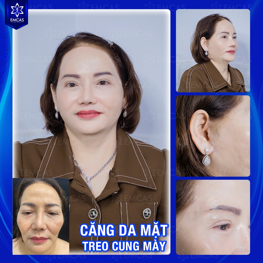 Cách Phòng Ngừa Và Điều Trị Lão Hóa Da Hiệu Quả