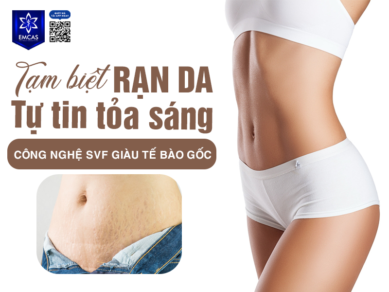 Tại Sao Da Bị Rạn Và Cách Phòng Tránh