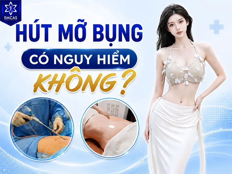 Hút mỡ bụng có thể tiềm ẩn rủi ro vì đây là thủ thuật phẫu thuật