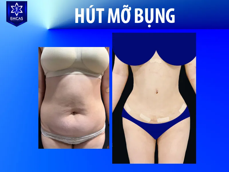 Bạn nên tái khám đúng lịch để bác sĩ đánh giá tiến độ vào form