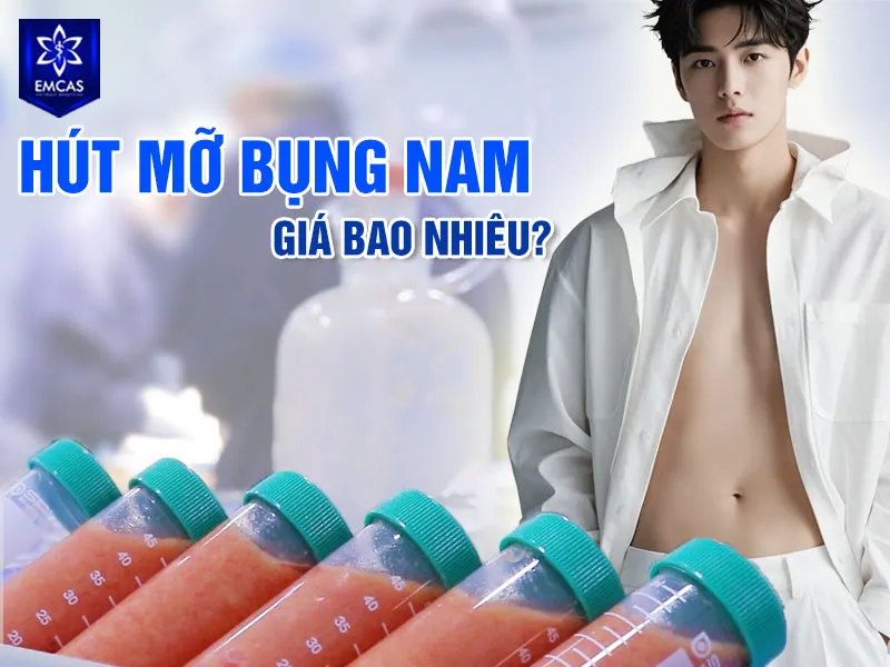 Chi phí và thời gian hồi phục sau hút mỡ bụng nam phụ thuộc vào lượng mỡ cần xử lý
