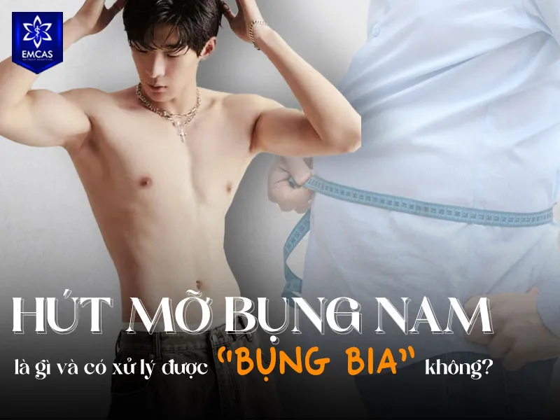 Hút mỡ bụng thường được cân nhắc cho nam giới có mỡ dưới da khu trú