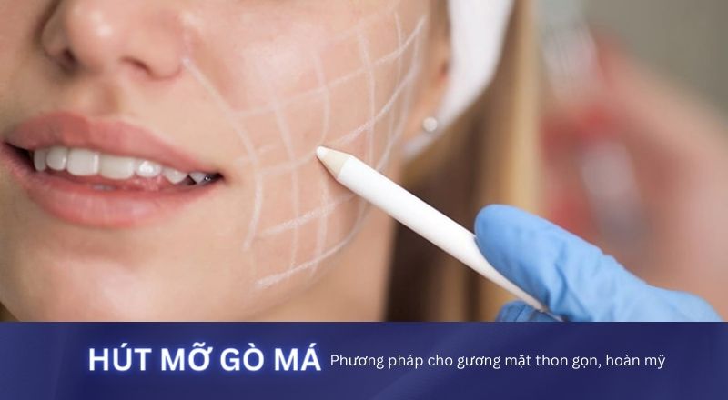 Hút Mỡ Má - Phương Pháp Mang Lại Gương Mặt Thon Gọn