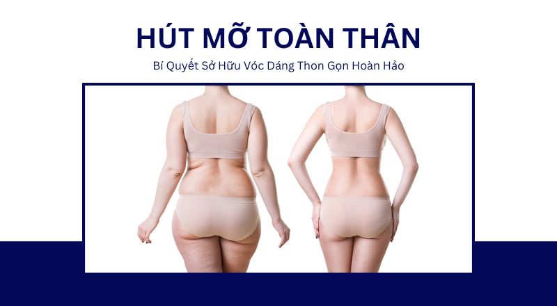 Hút Mỡ Toàn Thân - Bí Quyết Sở Hữu Vóc Dáng Thon Gọn Hoàn Hảo