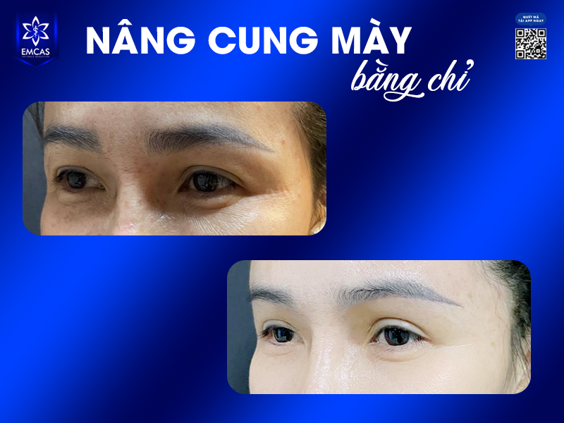 NÂNG CUNG MÀY BẰNG CHỈ