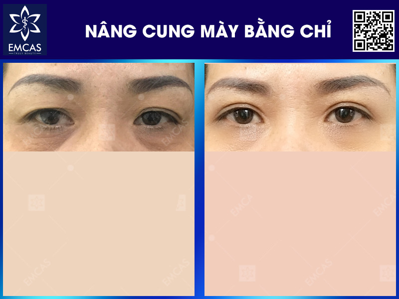 NÂNG CUNG CHÂN MÀY BẰNG CHỈ