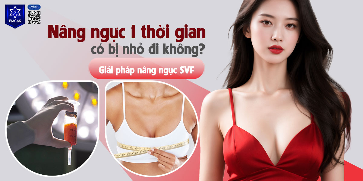 Nâng ngực 1 thời gian có bị nhỏ đi không? Giải pháp nâng ngực SVF