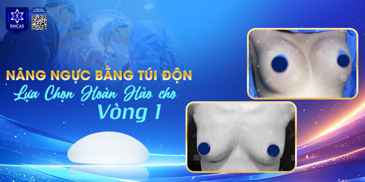 Nâng Ngực Bằng Túi Độn: Lựa Chọn Hoàn Hảo Cho Vòng 1