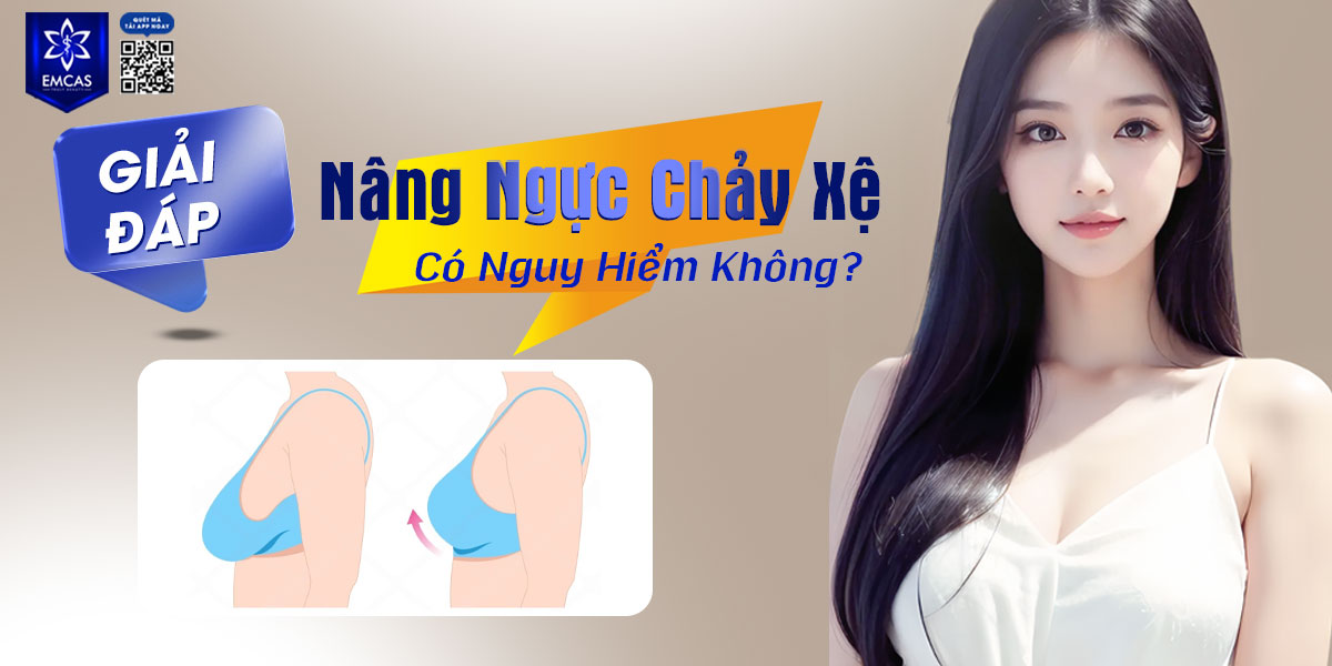 Giải Đáp - Nâng Ngực Chảy Xệ Có Nguy Hiểm Không?