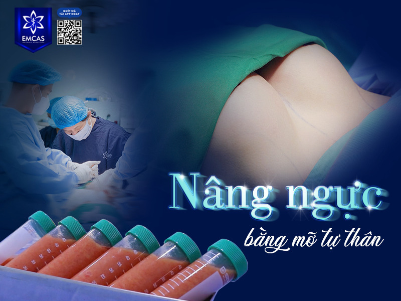 Tại TP.HCM, Bệnh Viện Thẩm Mỹ EMCAS là một trong những địa chỉ được nhiều người tin tưởng lựa chọn để thực hiện nâng ngực nội sinh.