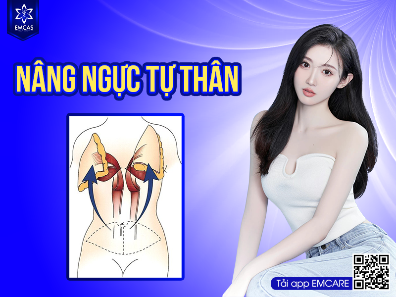 Nâng ngực tự thân hay nâng ngực bằng túi tự thân là một khái niệm mới, được nghiên cứu và phát triển bởi đội ngũ y bác sĩ của Bệnh viện thẩm mỹ EMCAS. Phương pháp này được dự đoán sẽ trở thành xu hướng làm đẹp trong tương lai.
