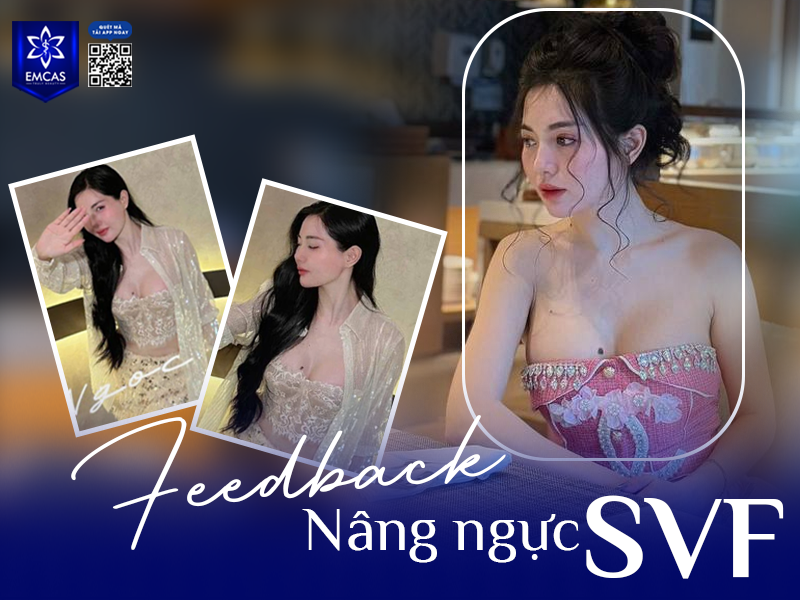 Bệnh Viện Thẩm Mỹ EMCAS không chỉ là địa chỉ thẩm mỹ giúp cải thiện vòng 1 mà còn mang đến trải nghiệm nâng ngực an toàn, tự nhiên và bền vững theo thời gian.