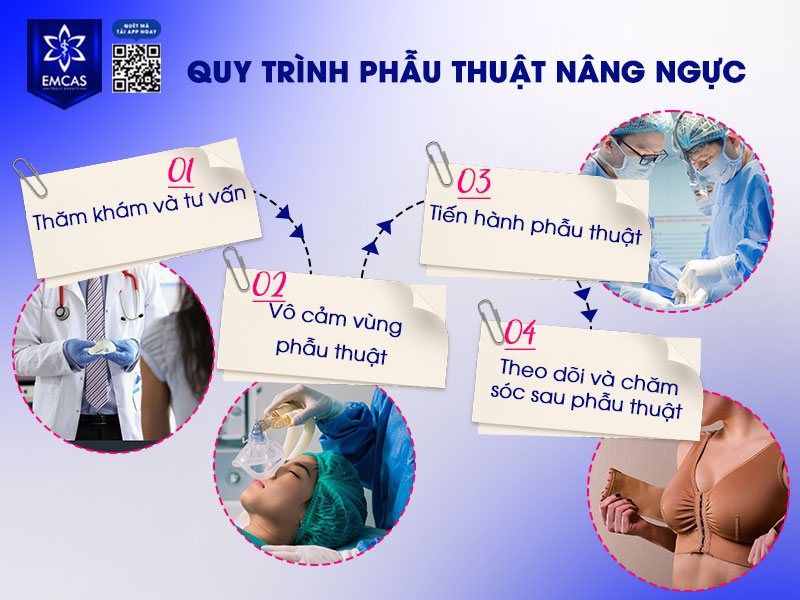 Quy trình nâng ngực được thực hiện theo trình tự y khoa gồm 5 bước: thăm khám, xét nghiệm, gây mê, phẫu thuật và chăm sóc hậu phẫu