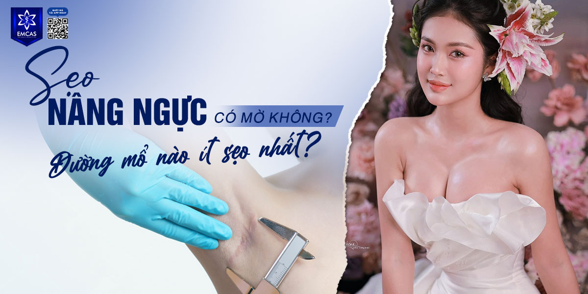 Sẹo nâng ngực là gì? Đường mổ nào ít sẹo nhất?