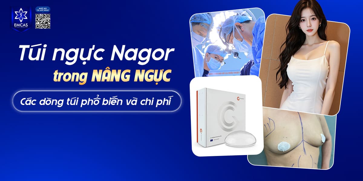 TÚI NGỰC NAGOR TRONG NÂNG NGỰC: CÁC DÒNG TÚI PHỔ BIẾN VÀ CHI PHÍ