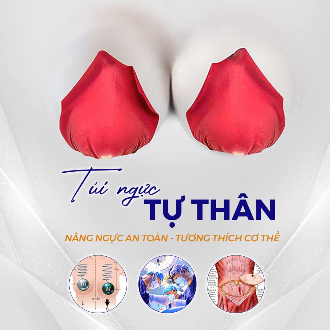 Túi Ngực Tự Thân - Nâng Ngực An Toàn, Tương Thích Với Cơ Thể