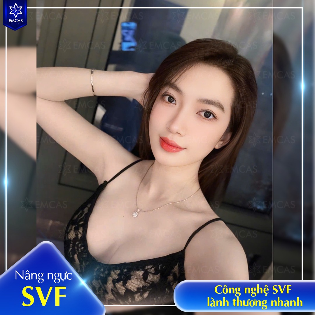 Nâng Ngực SVF - Ứng Dụng Công Nghệ Tế Bào Gốc