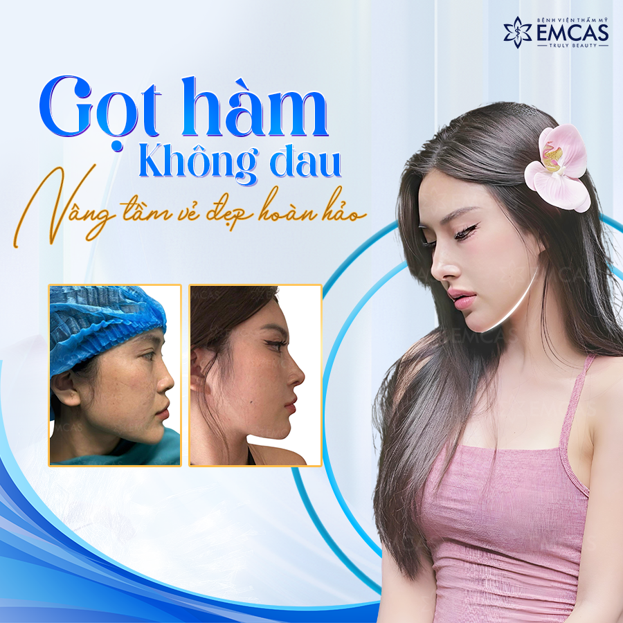 Chi Phí Gọt Hàm Bao Nhiêu? Yếu Tố Nào Ảnh Hưởng Đến Giá Gọt Hàm?