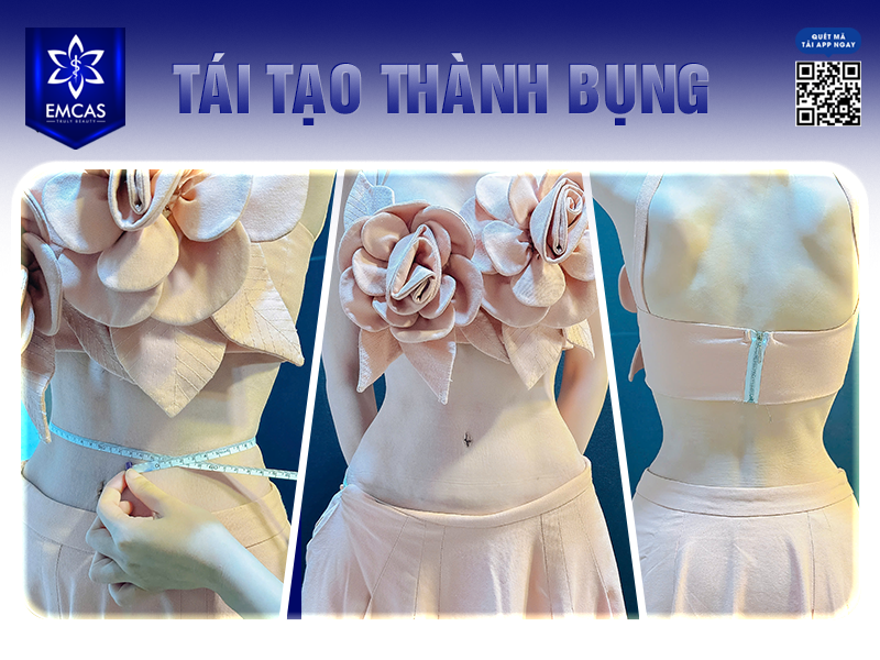 Tái Tạo Thành Bụng - Giải Pháp Cho Vòng Eo Thon Gọn