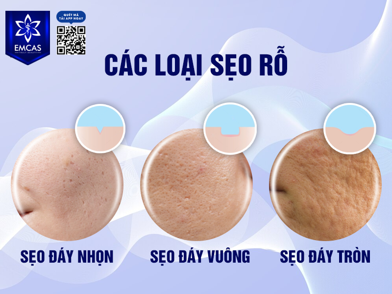 Những Vấn Đề Của Làn Da Và Phương Pháp Điều Trị