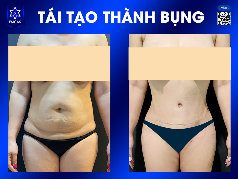 Những Phương Pháp Thu Gọn Vòng 2