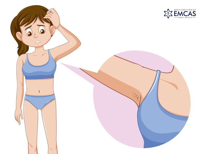 Vì Sao Ngực Bị Đau Ở Tuổi Dậy Thì?